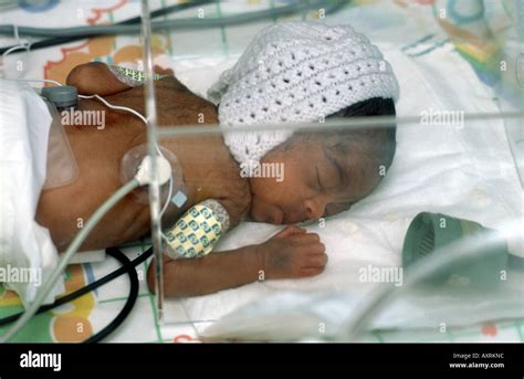 Premature Baby In An Incubator Stock Photo Alamy