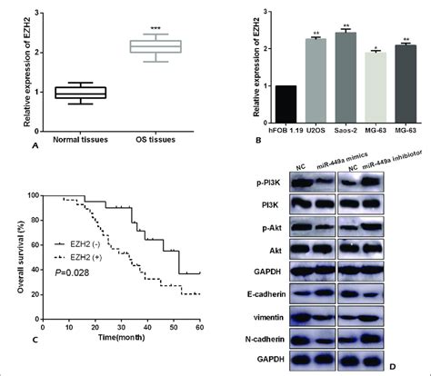 MiR 449a upregulation inactivated Wnt β catenin and EMT in OS cell