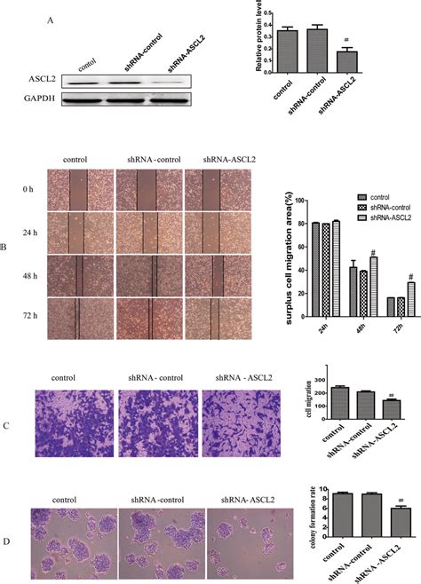 Ascl Promotes Gastric Cancer Cell Invasion And Metastasis A Ascl