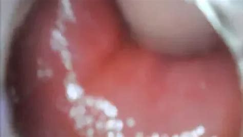 Endoscope Camera Inside My Ass Anal Anal Porn XHamster