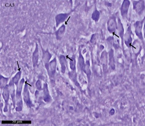 Photomicrographs of the hippocampus of albino rat from group IV ... 