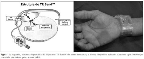 Scielo Brasil Valida O De Protocolo Para Obten O De Hemostasia