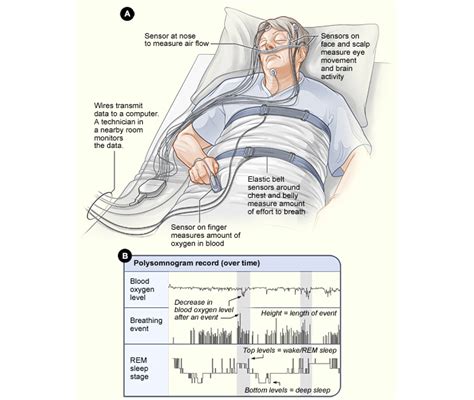 The Psg Sleep Monitoring National Heart Lung And Blood Institute