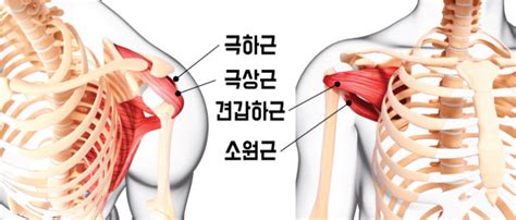 어깨 통증 관련 질환 회전근개파열 위례솔재활의학과의원