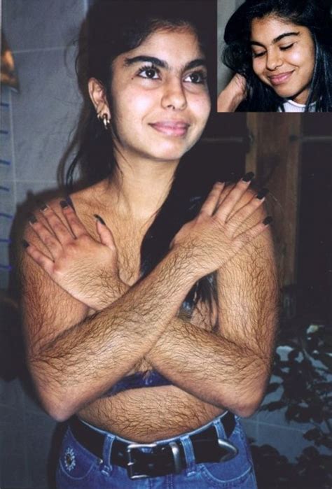 4680409437 Ebd4d9770b B  694×1024 Hirsutism Photo Hairy