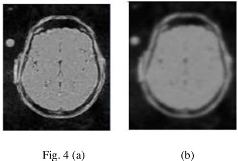 Figure From Performance Analysis For Mri Denoising Using Intensity