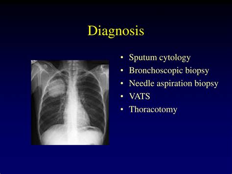 Ppt Common Thoracic Procedures Powerpoint Presentation Free Download