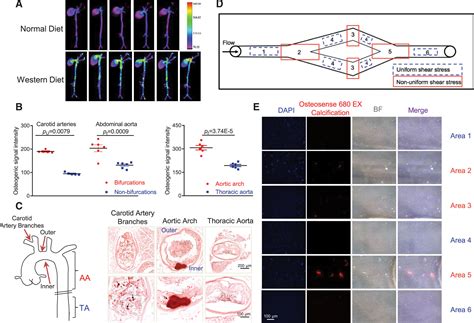 KLF2 Mediates The Suppressive Effect Of Laminar Flow On Vascular