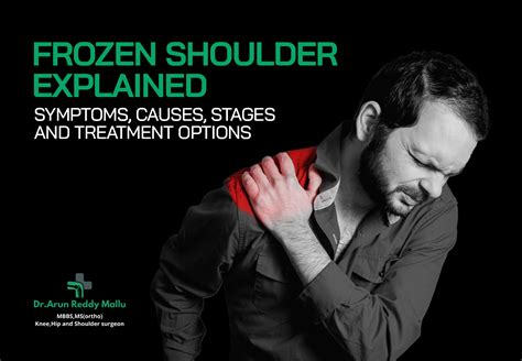 frozen shoulder explained symptoms  stages treatment
