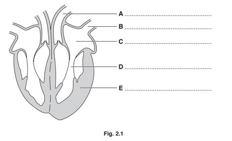 iGCSE Biology (0610)-9.2 Heart - iGCSE Style Questions Paper 3