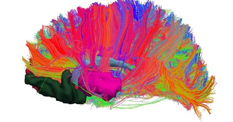 Sistema de recompensa del cerebro qué es y cómo funciona