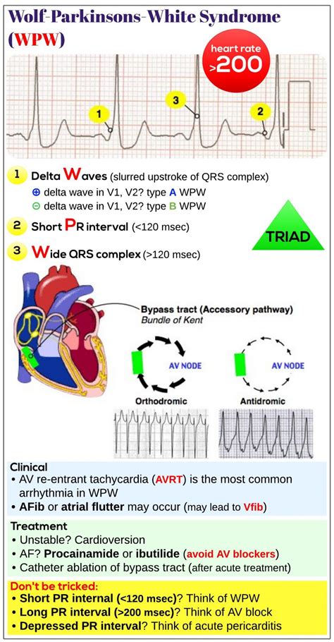 Wolf Parkinsons White Wpw Syndrome Medicine Keys For Mrcps