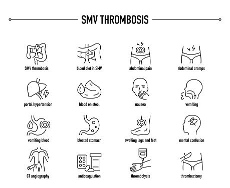 Smv Thrombosis Symptoms Diagnostic And Treatment Vector Icon Set Line ...