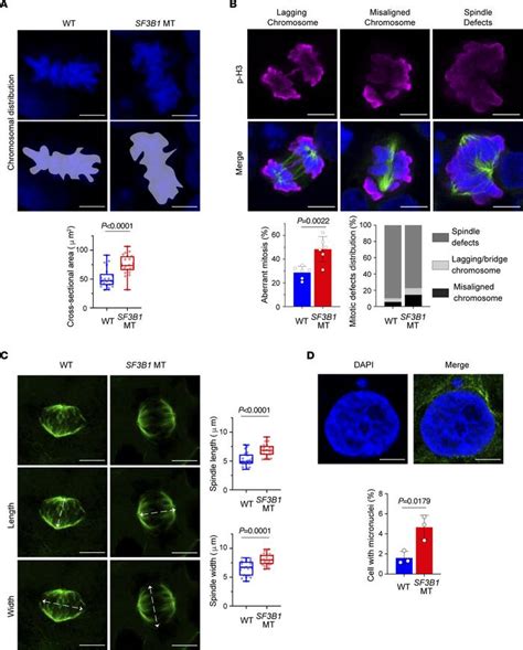 Jci Sf3b1 Mutation And Atm Deletion Codrive Leukemogenesis Via