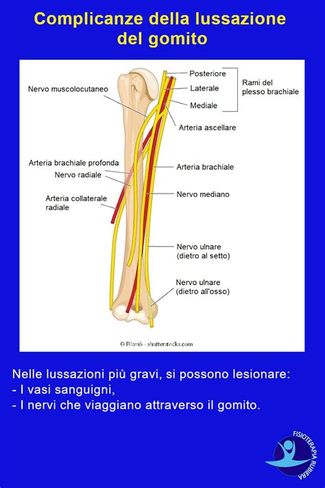 Lussazione Del Gomito I Rischi E La Terapia Pi Efficace