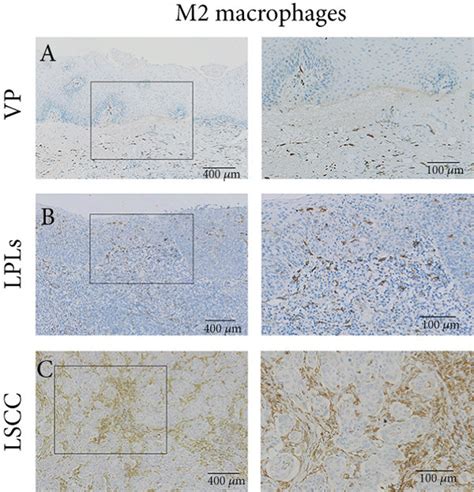 Immunohistochemical Staining And Semiquantitative Evaluation Of Hmgb1 Download Scientific