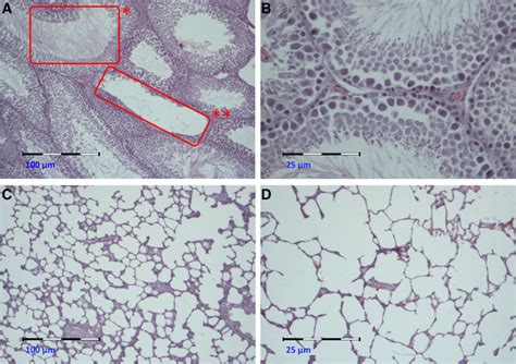 Histological Images Hematoxylin Eosin Staining Of A Testicle A B