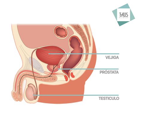 Diagnosis Y Tratamientos Para La Próstata Am Mallorca