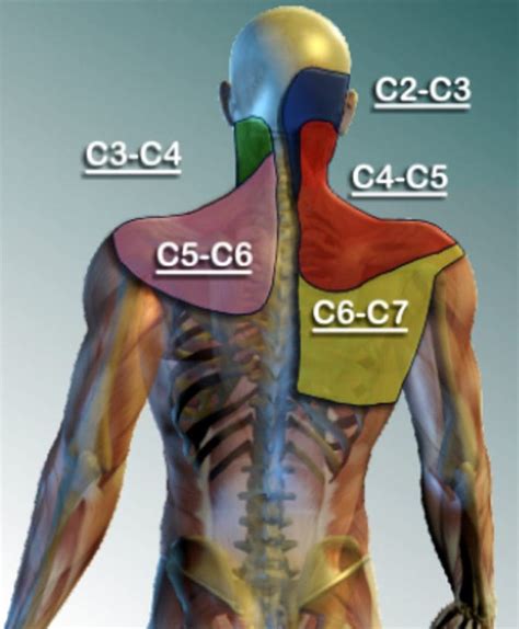 Cervical Facet Pain Map