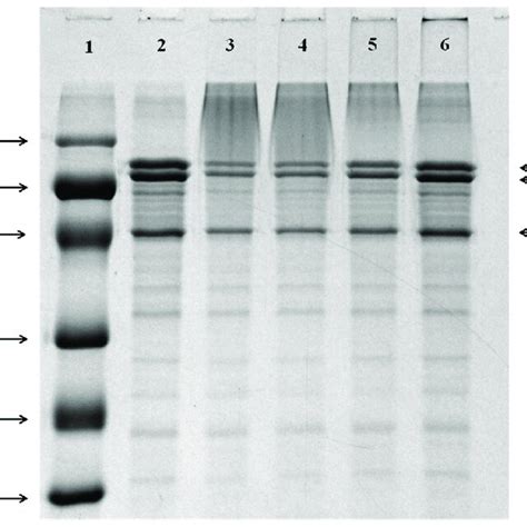 SDS PAGE Profiles Of 7S And 7S DEX Conjugates Obtained At 60 C And RH