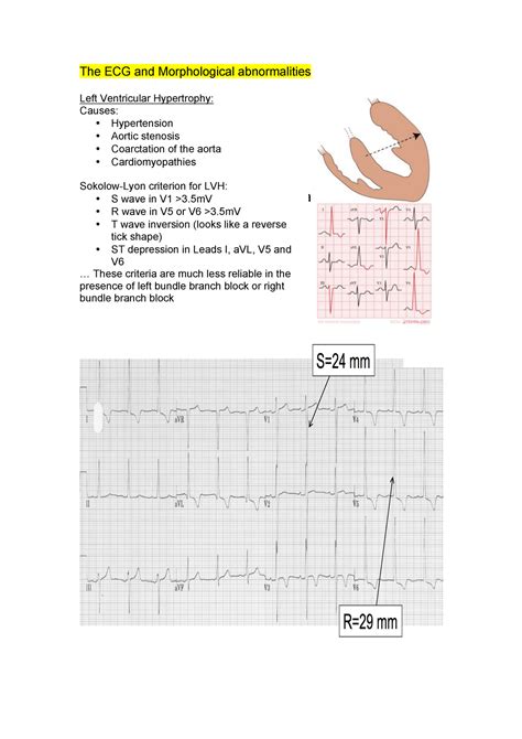 The Ecg And Morphological Abnormalities Difference Between Lvh And