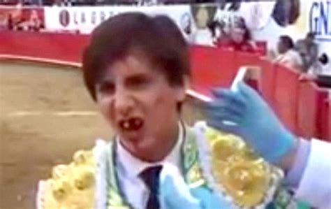 Teen Bullfighter Gored In BUM Five Months After He Took Horn In MOUTH