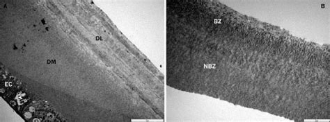 Transmission Electron Microscopy Of The Posterior Corneal Stroma A