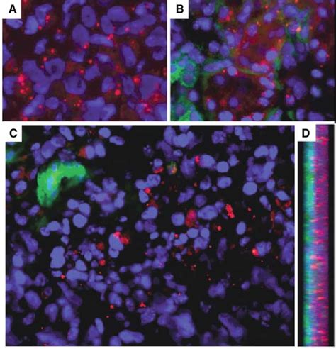 In Vivo Sirna Distribution In Heya Tumor I P After A Single