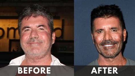 Simon Cowell Weight Loss: [2024] Before and After