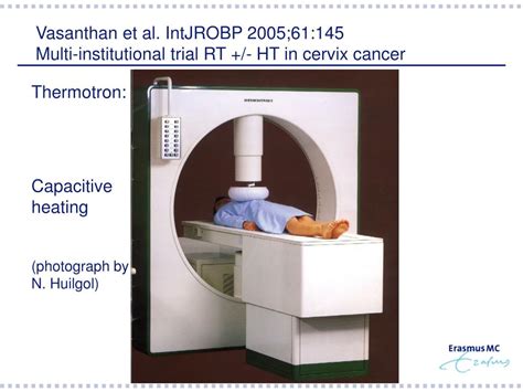 Ppt Radiotherapy And Hyperthermia In Cervical Cancer Powerpoint