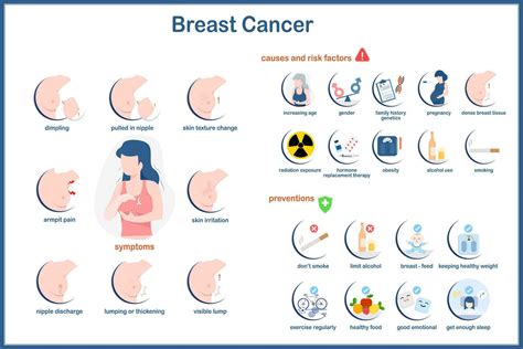 Medical Infographic Vector Illustration Of Breast Cancer In Flat Style