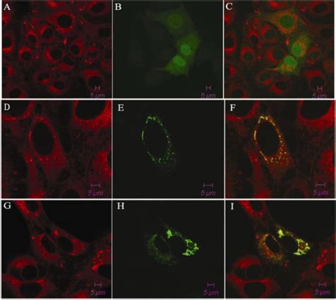 The Subcellular Localization Of The Pegfp Tap1 Fusion Protein In Pk 15