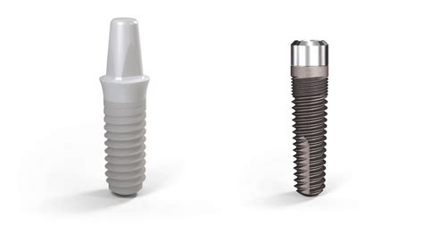 Zirconium Dental Implants In Costa Rica At America Dental Clinic