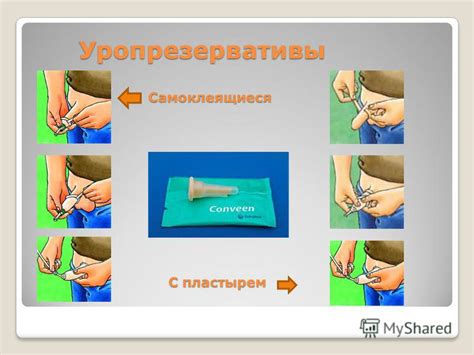Презентация на тему: "Дренажи в урологии Д.м.н., профессор Баженов И.В ...