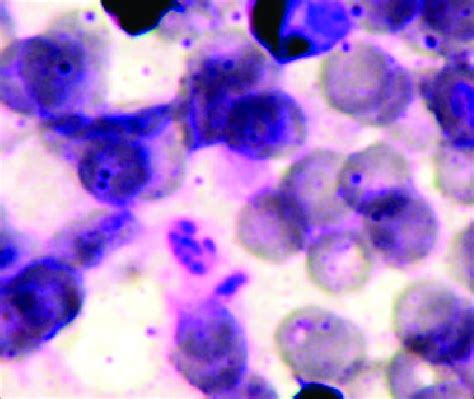 Giemsa Staining X 1000 Of P Jirovecii Cyst Containing Up To 8 Download Scientific Diagram