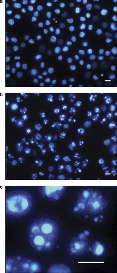 Fluorescence Microscopy Analysis Of U937 Cells Treated With