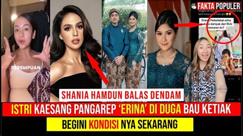 Reaksi Erina Gudono Dihujat Netizen Karena Bau Ketiak Begini Kondisi