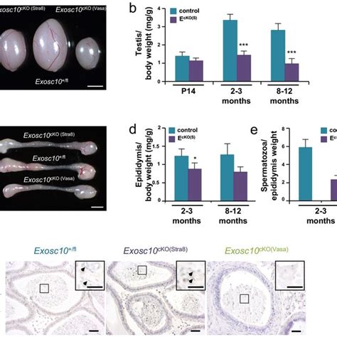 Histology And Marker Gene Expression In Epididymis And Testis Of