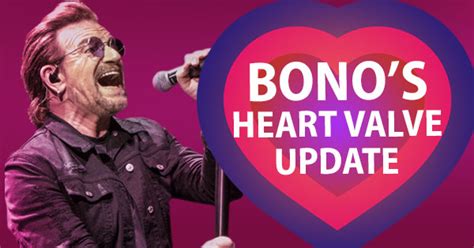 História de sucesso de cirurgia cardíaca Bono do U2 Renal