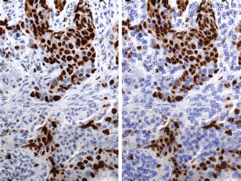 Secrets To Efficient Multiplex Ihc Analysis Revealed