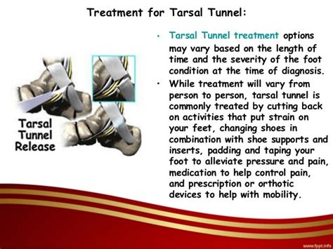 Tarsal Tunnel Treatment