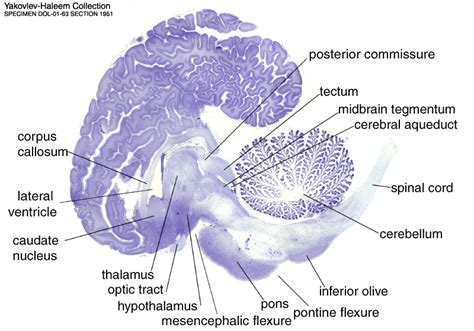 The Dolphin Brain Atlas at Michigan State University