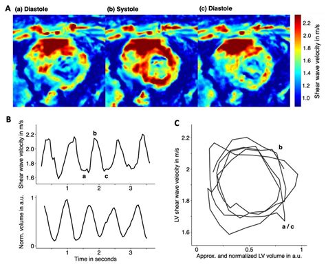 Rapid Multi Frequency Steady State Mr Elastography For Quantification