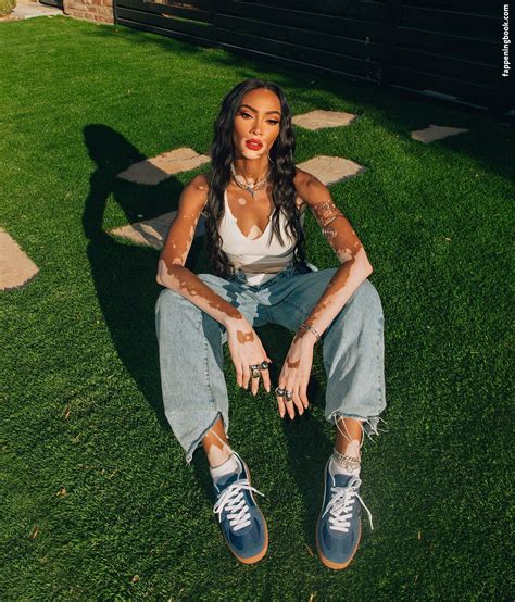 Winnie Harlow Nude The Fappening Photo Fappeningbook
