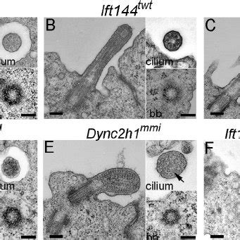 A subset of cilia markers is not detected in IFT-A mutant cilia. (A ...