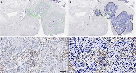 Immunohistochemical Staining Ihc And Measurement Of Cd