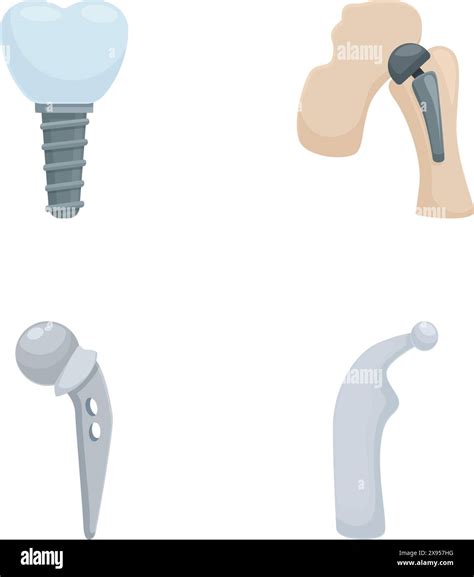 Vector Illustration Of Different Medical Implants For Dentistry And