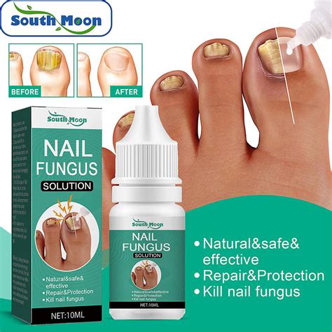 7days Fungal Nail Treatments Serum Repair Foot Onychomycosis Anti