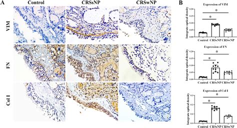 Increased Expression Of Vimentin Fn And Col In The Nasal Mucosa Of