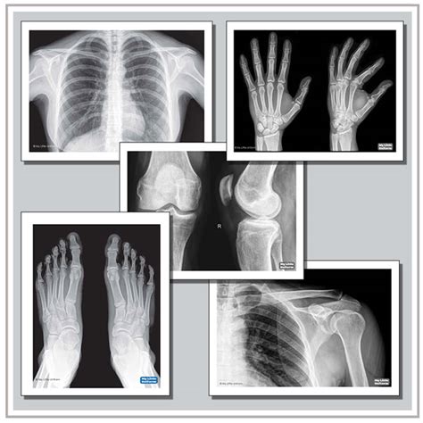 Printable Xrays